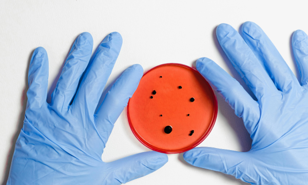 antimicrobial food additives, antimicrobial additives for food, food safety additives, shelf-life extension, microbial control in food, food additive regulation, GRAS antimicrobials, bacteriostatic and bactericidal agents